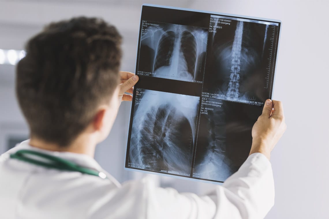 What Types of Irregularities Can XRays Detect? homehealthnv